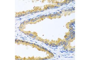 Immunohistochemistry of paraffin-embedded human prostate using KLK11 antibody. (Kallikrein 11 抗体)