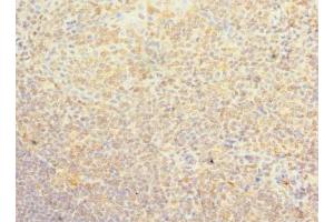Immunohistochemistry of paraffin-embedded human tonsil tissue using ABIN7163030 at dilution of 1:100 (PSD4 抗体  (AA 1-300))