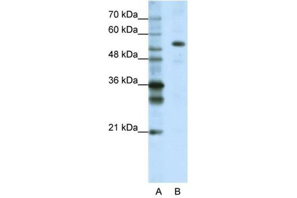 CPSF7 抗体  (C-Term)