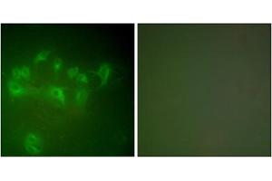 Immunofluorescence analysis of A549 cells, using MDM2 antibody (ABIN5976454). (MDM2 抗体  (C-Term))