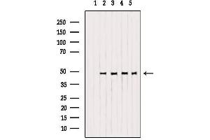 Mu Opioid Receptor 1 抗体  (C-Term)