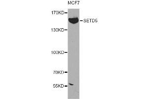 Western blot analysis of extracts of MCF-7 cells, using SETD5 antibody (ABIN5974406) at 1:300 dilution. (SETD5 抗体)