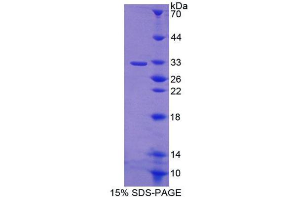 ABCB9 Protein (AA 500-762) (T7 tag,His tag)