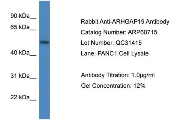 ARHGAP19 抗体  (C-Term)