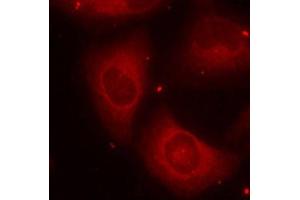 Immunofluorescence staining of methanol-fixed HeLa cells using Phospho-LIMK2-T505 antibody (ABIN2988124). (LIMK2 抗体  (pThr505))