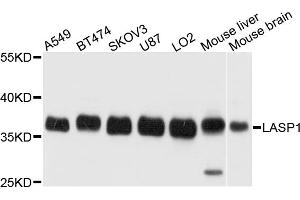 Western blot analysis of extracts of various cell lines, using LASP1 antibody (ABIN1873516) at 1:1000 dilution. (LASP1 抗体)