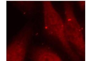 Immunofluorescence analysis of methanol-fixed HeLa cells using Phospho-ABL1(Y412) Polyclonal Antibody (ABL1 抗体  (pTyr412))