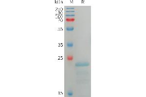 SPA17 Protein (AA 1-151) (His tag)