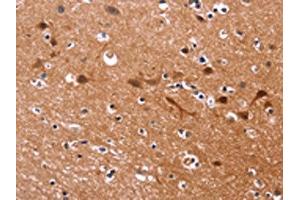 The image on the left is immunohistochemistry of paraffin-embedded Human brain tissue using ABIN7130270(MSH4 Antibody) at dilution 1/30, on the right is treated with fusion protein. (MSH4 抗体)