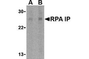 Western Blotting (WB) image for anti-RPA Interacting Protein (RPAIN) (C-Term) antibody (ABIN1030627) (RPAIN 抗体  (C-Term))