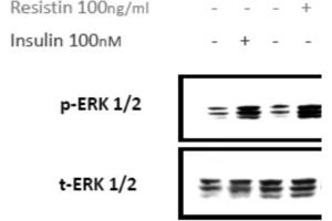 SDS-PAGE (SDS) image for Resistin Dimer protein (ABIN6700460)