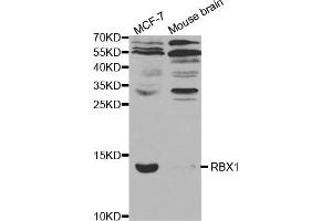 Western blot analysis of extracts of various cell lines, using RBX1 antibody (ABIN5970933) at 1/1000 dilution. (RBX1 抗体)