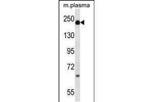 Western blot analysis in mouse plasma lysates (35ug/lane). (alpha 2 Macroglobulin 抗体  (N-Term))