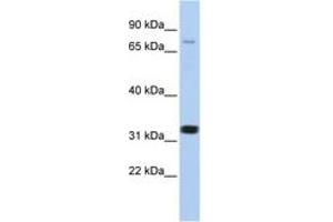 Image no. 1 for anti-Calcium Channel, Voltage-Dependent, beta 2 Subunit (CACNB2) (AA 21-70) antibody (ABIN6742718) (CACNB2 抗体  (AA 21-70))