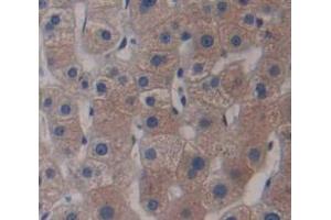 IHC-P analysis of Human Tissue, with DAB staining. (ADAM33 抗体  (AA 210-503))