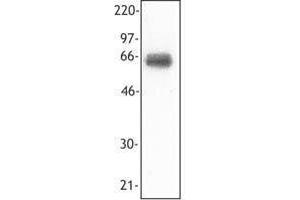 Western Blotting (WB) image for anti-Triggering Receptor Expressed On Myeloid Cells 1 (TREM1) antibody (ABIN2664607) (TREM1 抗体)