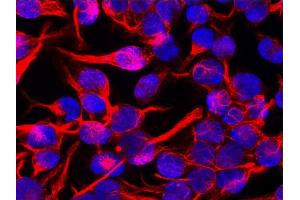 Immunofluorescence (IF) image for anti-Vimentin (VIM) antibody (ABIN94491)