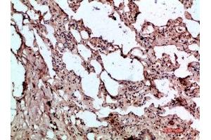 Immunohistochemical analysis of paraffin-embedded human-lung, antibody was diluted at 1:200. (GDF2 抗体  (AA 371-420))