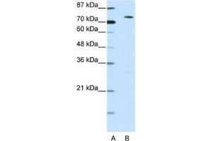 Western Blotting (WB) image for anti-MYST Histone Acetyltransferase 2 (MYST2) antibody (ABIN2460592) (MYST2 抗体)