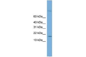 WB Suggested Anti-CST8 Antibody Titration: 0. (CST8 抗体  (Middle Region))