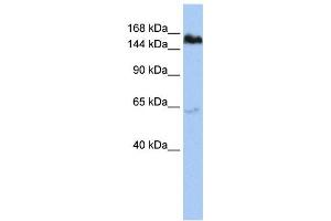 Western Blotting (WB) image for anti-Tankyrase, TRF1-Interacting Ankyrin-Related ADP-Ribose Polymerase (TNKS) antibody (ABIN2458044) (TNKS 抗体)