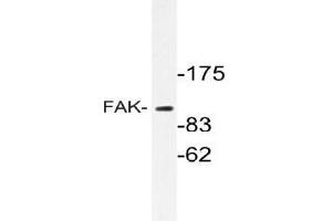 Western blot (WB) analyzes of FAK antibody in extracts from HT-29 cells. (FAK 抗体)