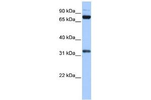 WB Suggested Anti-TAF6 Antibody Titration:  0. (TAF6 抗体  (C-Term))