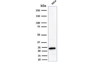 Western Blotting (WB) image for anti-Ferritin, Light Polypeptide (FTL) (AA 38-165) antibody (ABIN6939463)