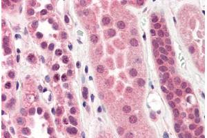 Human Kidney (formalin-fixed, paraffin-embedded) stained with STEAP1 antibody ABIN364397 at 10 ug/ml followed by biotinylated anti-mouse IgG secondary antibody ABIN481714, alkaline phosphatase-streptavidin and chromogen. (STEAP1 抗体  (AA 1-70))