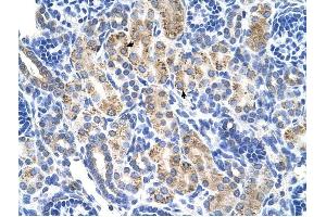 ALDH3A2 antibody was used for immunohistochemistry at a concentration of 4-8 ug/ml to stain Epithelial cells of renal tubule (arrows) in Human Kidney. (ALDH3A2 抗体  (C-Term))