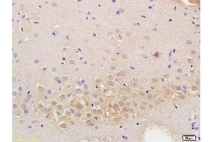 Formalin-fixed and paraffin embedded mouse kidney labeled with Anti RASSF3 Polyclonal Antibody, Unconjugated (ABIN762101) at 1:200 followed by conjugation to the secondary antibody and DAB staining (RASSF3 抗体  (AA 51-150))