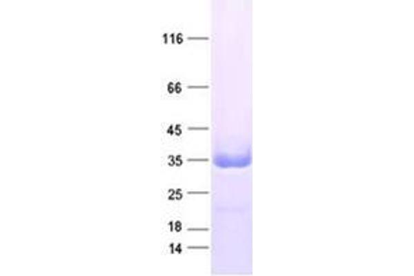 ZFAND5 Protein (DYKDDDDK Tag)