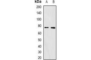 Western blot analysis of FURIN expression in A375 (A), mouse ovary (B) whole cell lysates. (FURIN 抗体)