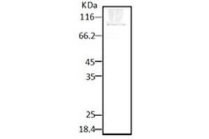 Western blot analysis of Parasite Lysates showing detection of HSP90 protein using Rabbit Anti-HSP90 Polyclonal Antibody . (HSP90 抗体  (FITC))