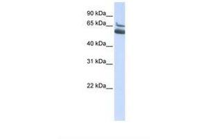 Image no. 1 for anti-Arachidonate 15-Lipoxygenase B (ALOX15B) (N-Term) antibody (ABIN6738008) (ALOX15B 抗体  (N-Term))