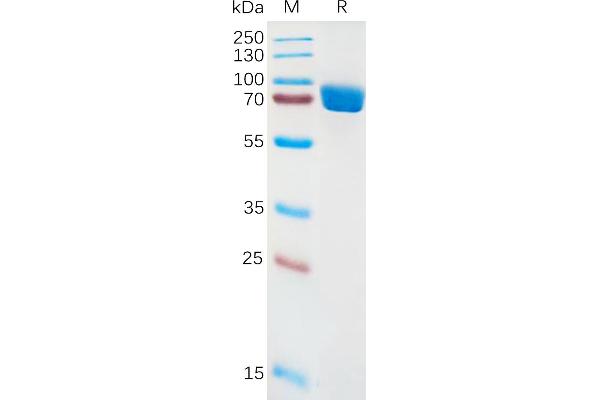 IL1RN Protein (AA 18-332) (Fc Tag)