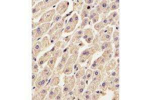 (ABIN391619 and ABIN2841538) staining ANXA2 in Human liver tissue sections by Immunohistochemistry (IHC-P - paraformaldehyde-fixed, paraffin-embedded sections). (Annexin A2 抗体  (N-Term))