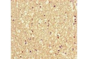 Immunohistochemistry of paraffin-embedded human brain tissue using ABIN7175471 at dilution of 1:100 (VAMP1 抗体  (AA 1-96))