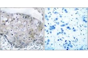 Immunohistochemistry (IHC) image for anti-VEGF Receptor 2 (VEGFR2) (pTyr951) antibody (ABIN2888557) (VEGFR2/CD309 抗体  (pTyr951))