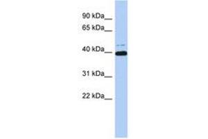 Image no. 1 for anti-MYC-Associated Zinc Finger Protein (Purine-Binding Transcription Factor) (MAZ) (AA 179-228) antibody (ABIN6742437) (MAZ 抗体  (AA 179-228))