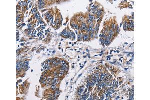 Immunohistochemistry (IHC) image for anti-Natriuretic Peptide A (NPPA) antibody (ABIN2422905) (NPPA 抗体)