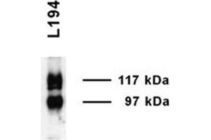 Western blot analysis of Rat Inner medulla showing detection of UT-A1 protein using Rabbit Anti-UT-A1 Polyclonal Antibody . (Solute Carrier Family 14 (Urea Transporter, Kidney) Member 2 (SLC14A2) (AA 911-929) 抗体 (Atto 390))