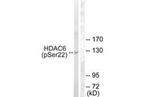 Western blot analysis of extracts from NIH-3T3 cells treated with Anisomycin 25ug/ml 30', using HDAC6 (Phospho-Ser22) Antibody. (HDAC6 抗体  (pSer22))