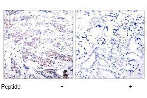 Image no. 1 for anti-ELK1, Member of ETS Oncogene Family (ELK1) (Ser383) antibody (ABIN197098) (ELK1 抗体  (Ser383))