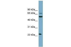 WB Suggested Anti-CLEC6A Antibody Titration:  0. (C-Type Lectin Domain Family 6, Member A (CLEC6A) (N-Term) 抗体)