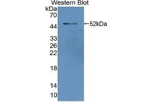 Detection of Recombinant LMNA, Human using Polyclonal Antibody to Lamin A/C (LMNA) (Lamin A/C 抗体  (AA 1-422))