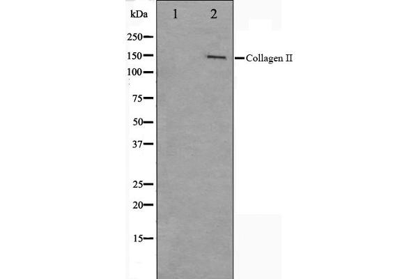 COL2A1 抗体  (N-Term)