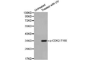 Western blot analysis of extracts from HeLa cells using Phospho-CDK2-T160 antibody (ABIN2987938). (CDK2 抗体  (pThr160))