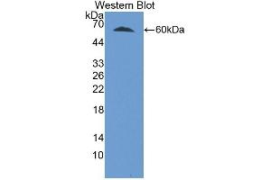 Detection of Recombinant TERT, Mouse using Polyclonal Antibody to Telomerase Reverse Transcriptase (TERT) (TERT 抗体  (AA 642-974))