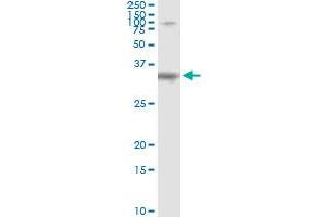 Immunoprecipitation (IP) image for anti-Syndecan Binding Protein (Syntenin) (SDCBP) (AA 1-100) antibody (ABIN562830)